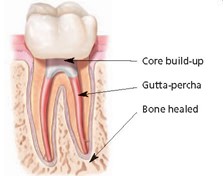 anatomy of tooth 2