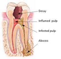 anatomy of tooth